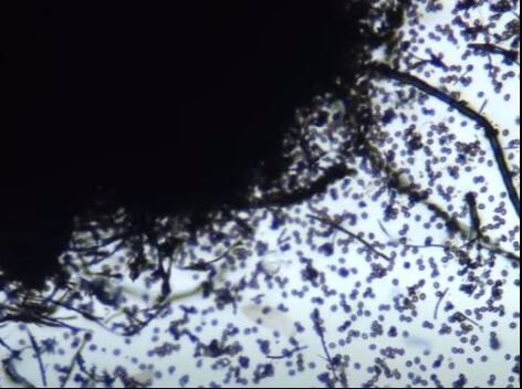 Black Toxic Mold under Microscope Farmville VA Hero Mold Removal